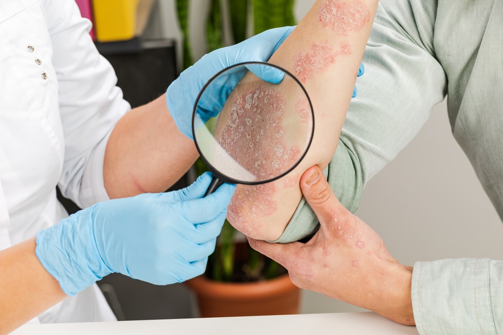 A,Dermatologist,Wearing,Gloves,Examines,The,Skin,Of,A,Sick